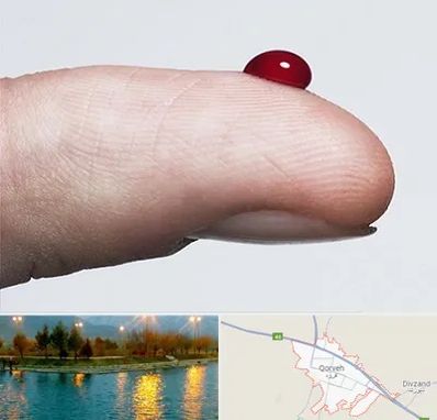 مرکز فصد خون در قروه