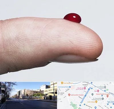 مرکز فصد خون در خیابان ملاصدرا شیراز