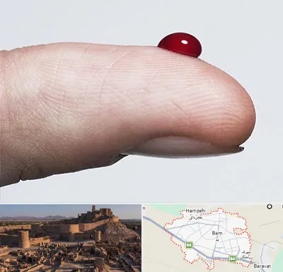 مرکز فصد خون در بم
