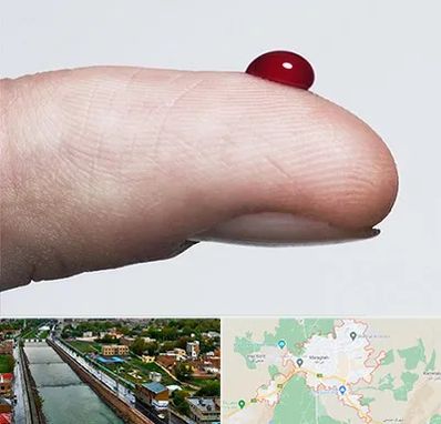 مرکز فصد خون در مراغه