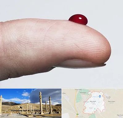 مرکز فصد خون در مرودشت