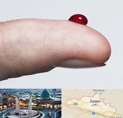 مرکز فصد خون در زنجان