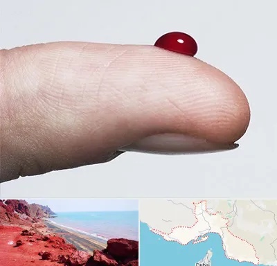 مرکز فصد خون در هرمزگان