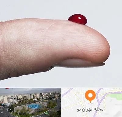 مرکز فصد خون در تهران نو
