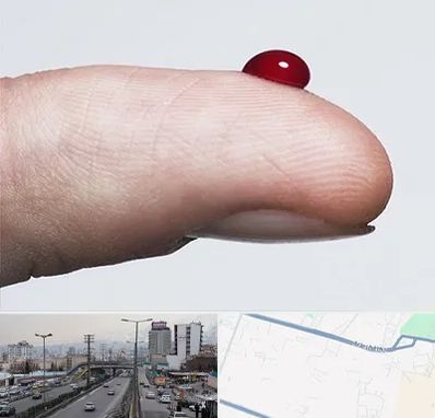 مرکز فصد خون در بلوار ارتش