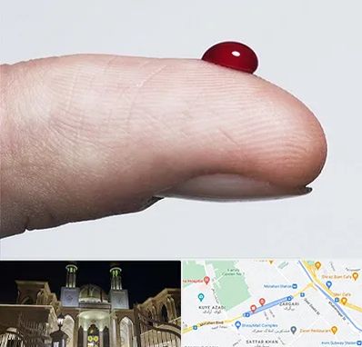 مرکز فصد خون در زرگری شیراز