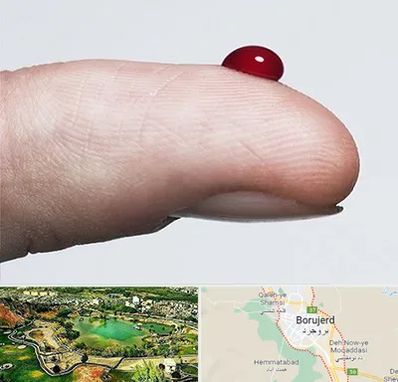 مرکز فصد خون در بروجرد