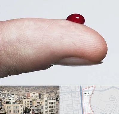 مرکز فصد خون در اسکندری