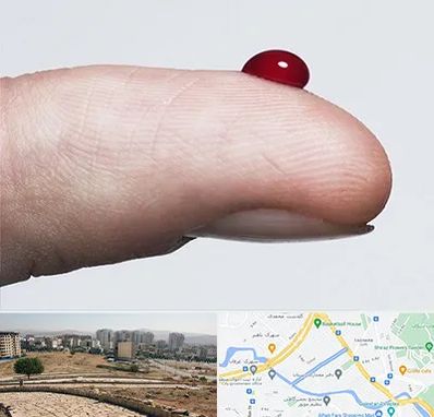 مرکز فصد خون در کوی وحدت شیراز