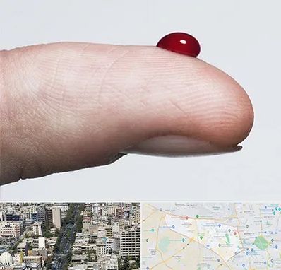 مرکز فصد خون در منطقه 18 تهران