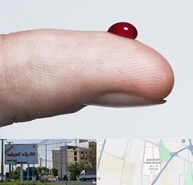 مرکز فصد خون در فاز یک اندیشه