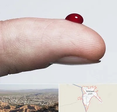 مرکز فصد خون در اسفراین