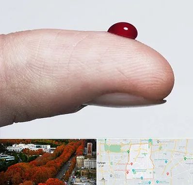 مرکز فصد خون در منطقه 6 تهران