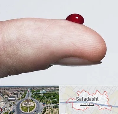 مرکز فصد خون در صفادشت