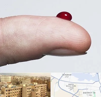 مرکز فصد خون در جنوب غرب تهران