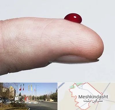 مرکز فصد خون در مشکین دشت