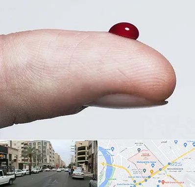 مرکز فصد خون در زیتون کارمندی اهواز