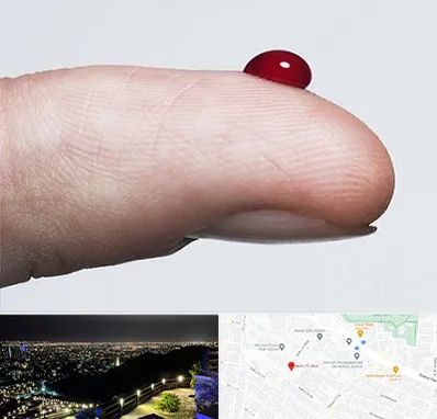 مرکز فصد خون در هفت تیر مشهد