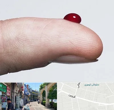 مرکز فصد خون در خیابان قزوین