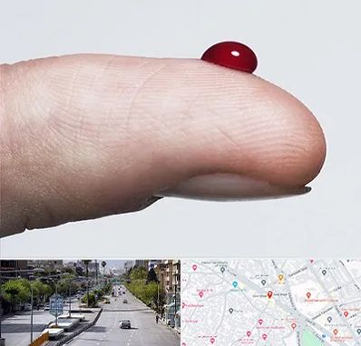 مرکز فصد خون در خیابان زند شیراز