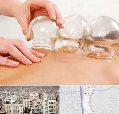 بادکش درمانی در اسکندری