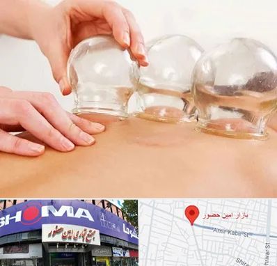 بادکش درمانی در امین حضور