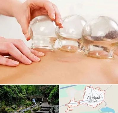 بادکش درمانی در علی آباد کتول