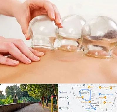 بادکش درمانی در بلوار گیلان رشت