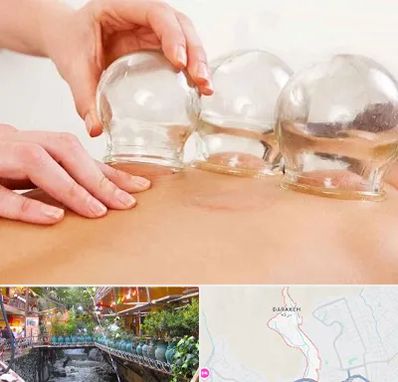 بادکش درمانی در درکه