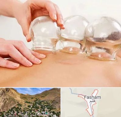 بادکش درمانی در فشم