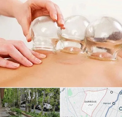 بادکش درمانی در دروس
