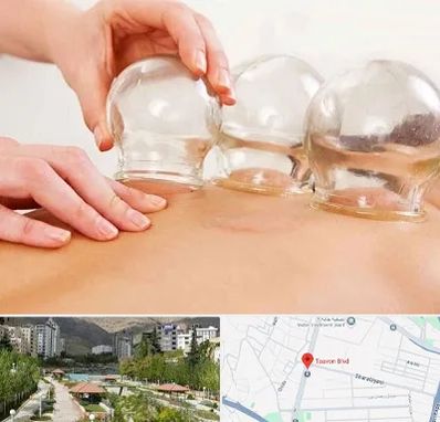 بادکش درمانی در بلوار تعاون