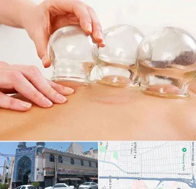 بادکش درمانی در بلوار ابوذر