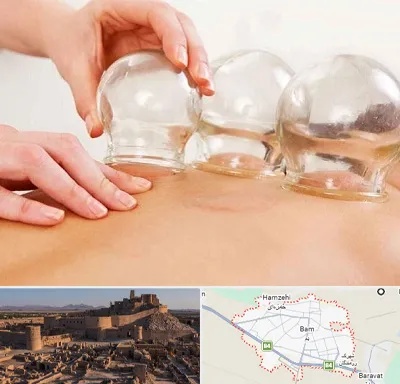 بادکش درمانی در بم