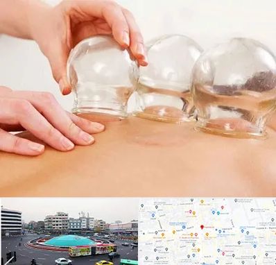 بادکش درمانی در میدان انقلاب