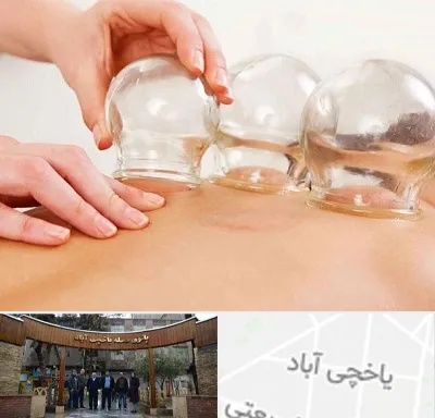 بادکش درمانی در یاخچی آباد