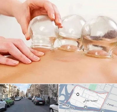 بادکش درمانی در مجیدیه شمالی