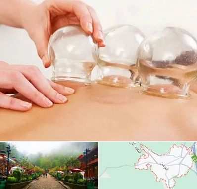 بادکش درمانی در فومن
