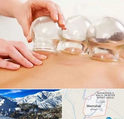 بادکش درمانی در شمشک