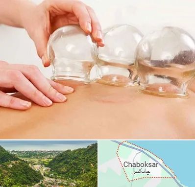 بادکش درمانی در چابکسر