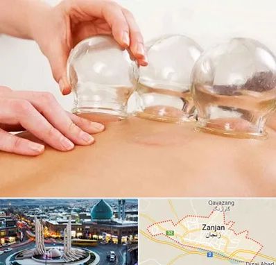 بادکش درمانی در زنجان