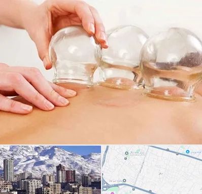 بادکش درمانی در ازگل