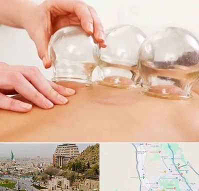 بادکش درمانی در فرهنگ شهر شیراز