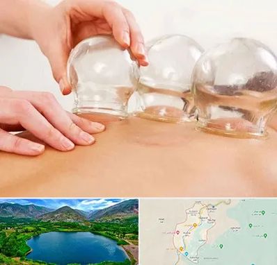 بادکش درمانی در رودبار