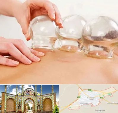 بادکش درمانی در سمنان