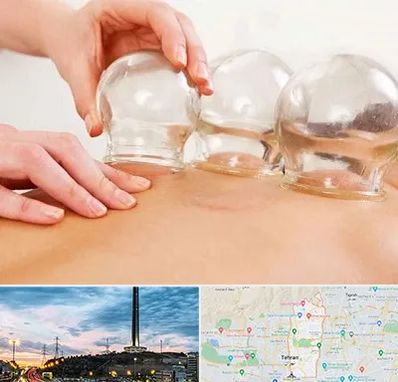 بادکش درمانی در منطقه 2 تهران