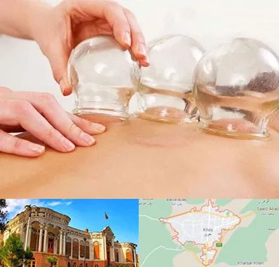 بادکش درمانی در خوی