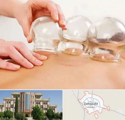 بادکش درمانی در دهدشت
