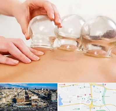 بادکش درمانی در شهرک راه آهن