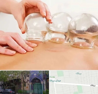 بادکش درمانی در بریانک
